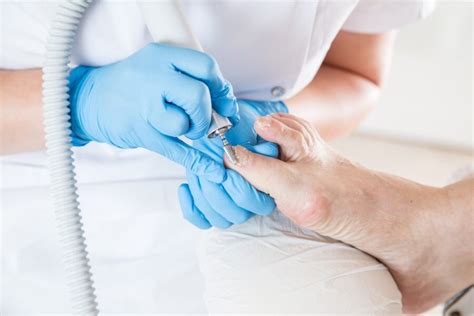 PiedRéseau Boisbriand : L’ongle traumatique : symptômes et traitements