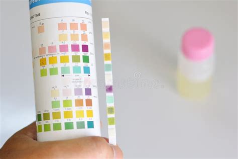Analyse d'urine image stock. Image du analyser, urinalysis - 25306397
