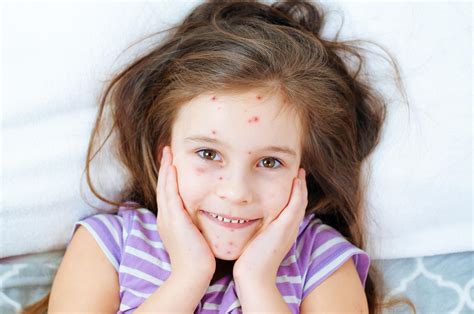 Varicelle : symptômes, diagnostic et traitement | Cerballiance