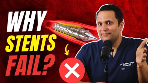 Why heart Stents Fail? Explained by Cardiologist
