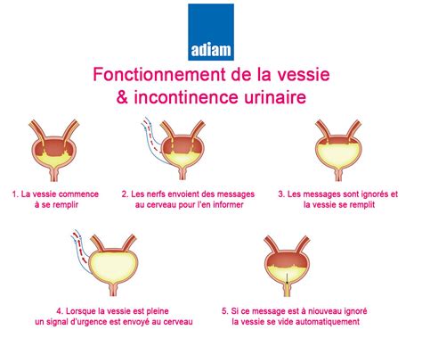 Incontinence urinaire : traitement, symptome et aide à domicile | Paris