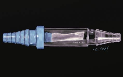 Drainage pleural ou thoracique, thoracostomie | thoracotomie