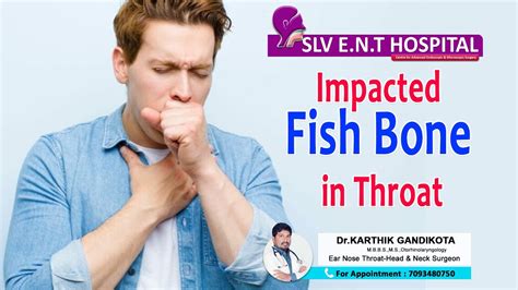 Impacted Fish bone in throat - YouTube