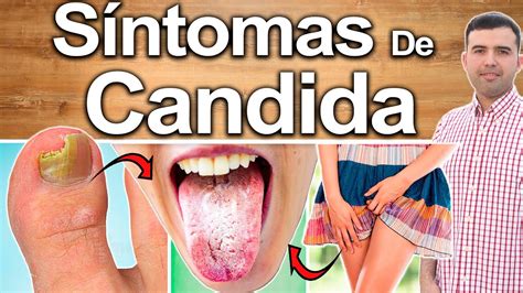 Síntomas De Cándida En Tu Cuerpo - Signos Que Revelan Hongos, Y Cómo ...
