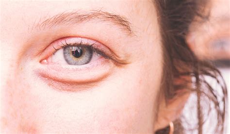 Voilà comment faire disparaître les poches sous les yeux qu'on a tous ...