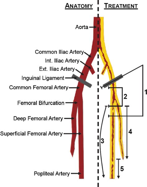 Superficial Femoral Artery Anatomy