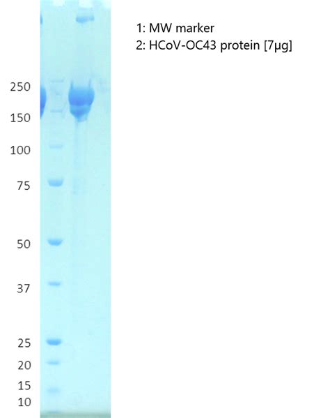 Coronavirus OC43 full-length Spike - The Native Antigen Company