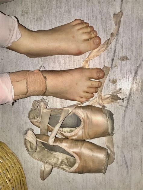 Damaged Ballerina Feet ️‍🩹 | Ballerina feet, Foot pictures, Ballerina