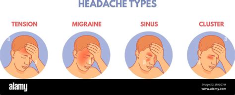 Types de maux de tête. Zones de migraines diagramme infographique ...