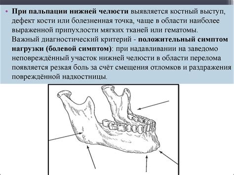 Аппараты воспроизводящие движения нижней челюсти презентация