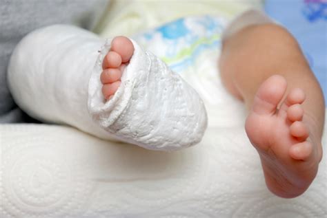 Broken Bone Birth Injuries | NY & NJ Medical Malpractice Lawyer