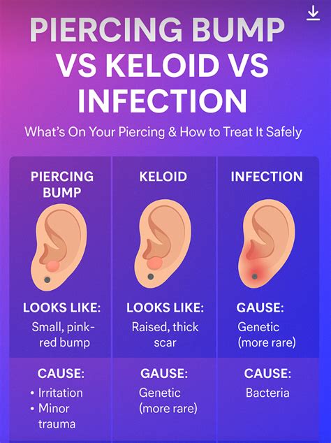 Piercing Bump vs Keloid vs Infection: How to Tell the Difference & Tre ...