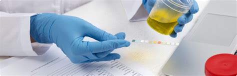 Conservation des analyses de selles et d'urine - Koovea