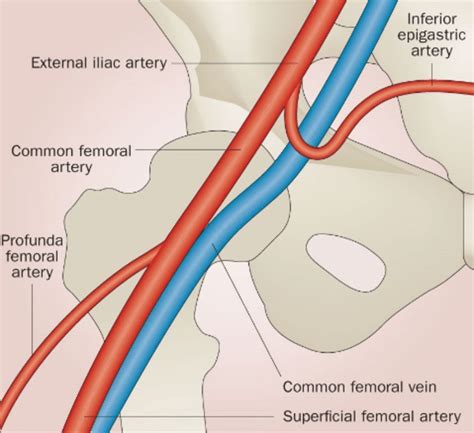 The common femoral vein is measured at the level immediately proximal ...