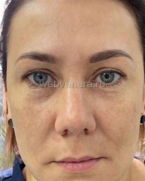 Холодная плазма: цена процедуры и другая полезная информация | webvenera.ru