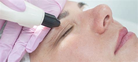 Холодная плазма в косметологии для лица — отзывы, побочные действия ...