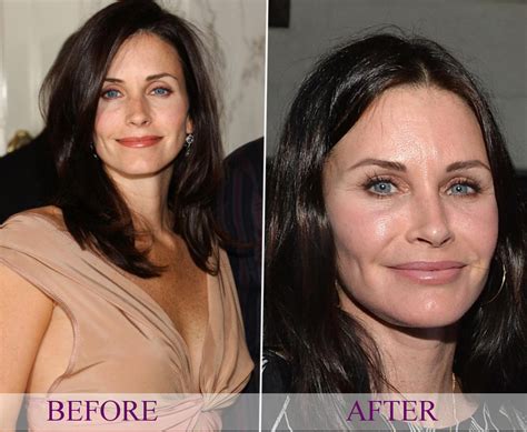 Celebrity Courteney Cox - plastic surgery, photos, video