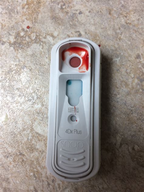 The 4DX Snap Test Explained, By Leigh Chisholm At Seasons