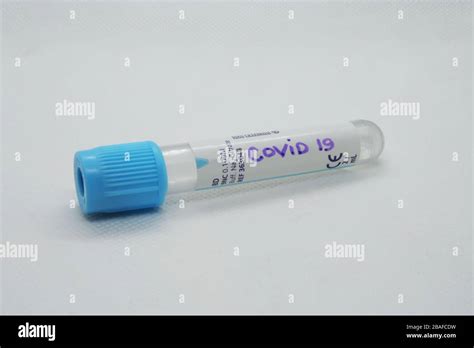 Virus test tube. Testing virus. Viral infection test Stock Photo - Alamy