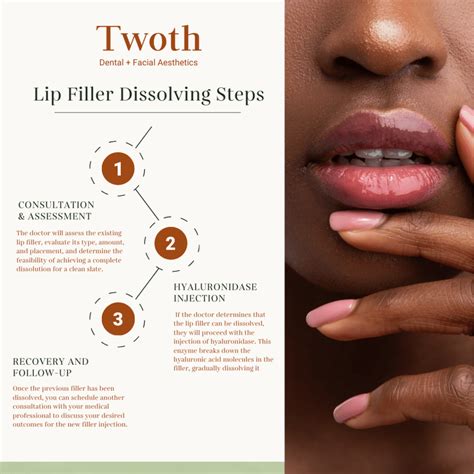 Filler Dissolving St John's Wood—London