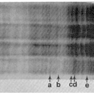 Protein patterns of Caenorhabditis briggsae strains 1-4 separated by ...