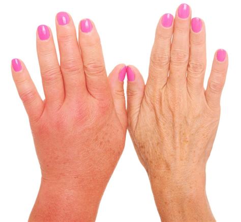 Fingertip Red And Hot at Susan Jaimes blog