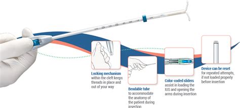 Ob/Gyn Updated : New Single Handed IUD Inserter for LILETTA released ...