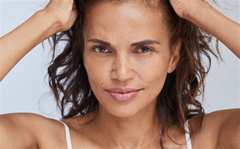 La calvitie chez la femme | Maison Lutetia