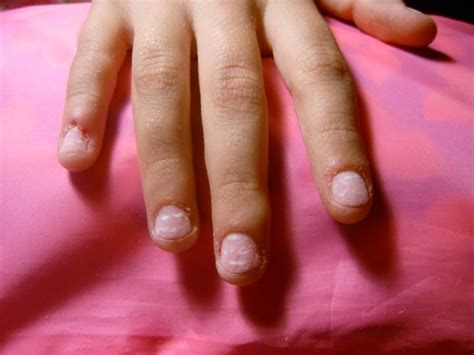 Mangiarsi le PELLICINE delle mani