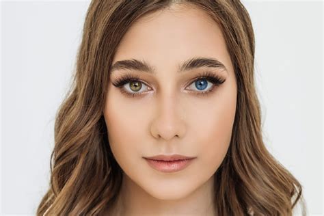 Hétérochromie (yeux vairons) : partielle, complète, quelles causes