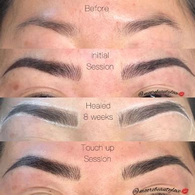 Microblading Treatment in Kolkata - Microblading Eyebrows Clinic | La Derma