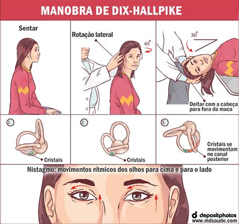 VPPB: doença dos critais, tontura ao mexer a cabeça – Dra Kênia Chaves