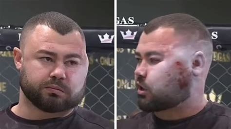 Slap Fighting: Fighter’s face left disfigured, video, Sorin Comsa ...