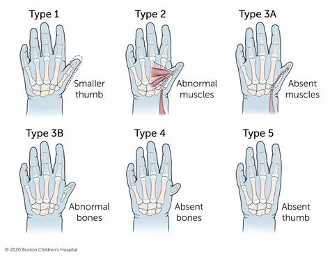 Area Between The Thumb And Index Finger