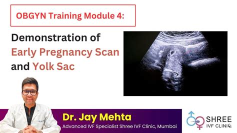 OBGYN Training Module 4: Demonstration of Early Pregnancy Scan and Yolk ...