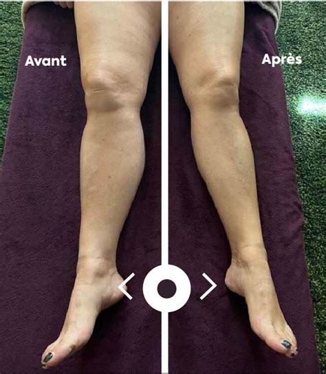 Drainage Lymphatique Renata França Troyes | C'est par ici