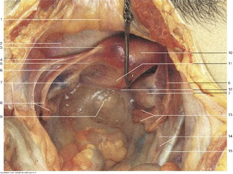 Female Reproductive Practical 2 Picture 3 Diagram Quizlet