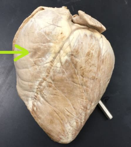 Ap Ii Lab Practical Sheep Heart Flashcards Quizlet