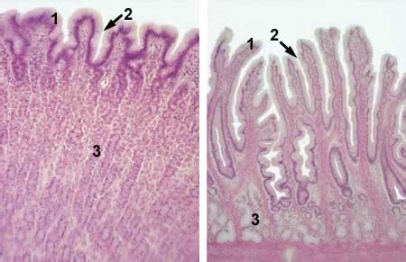 Lab 3 Stomach Fundus Histology Flashcards Quizlet