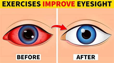 Six Essential Herbs To Repair Vision And Protect Eyes Naturally