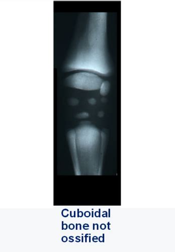 Imaging Of Juvenile Developmental Disease In Equine Flashcards Quizlet