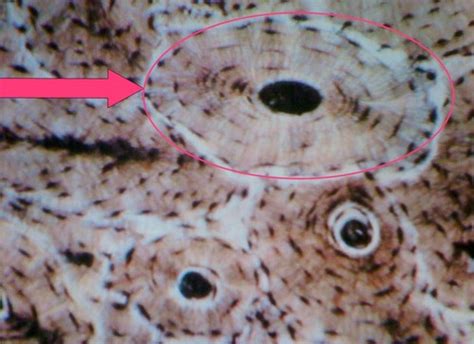 A P Lab Week 4 Bone Histology Flashcards Quizlet