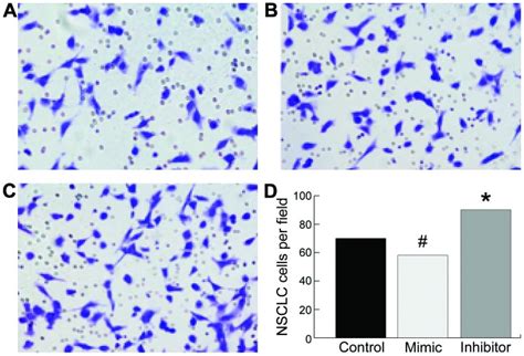 MiR 215 Suppresses Proliferation And Migration Of Non Small Cell Lung