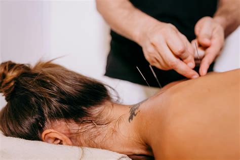 Acupuncture With Electricity Vs Traditional Acupuncture Understanding