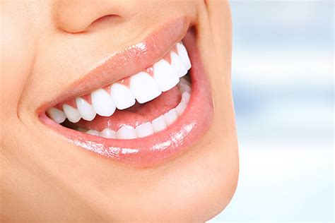 Can My Dental Implants Be Whitened And Other Frequently Asked