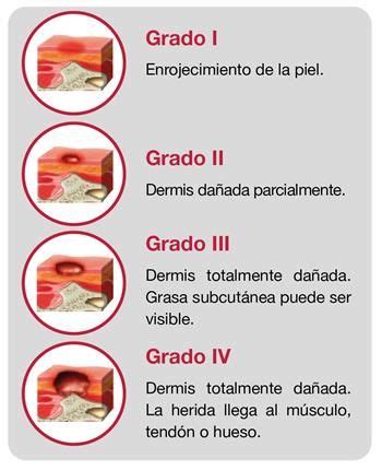 Pin De Corivelu En Paciente En Cama Enfermer A Obstetricia