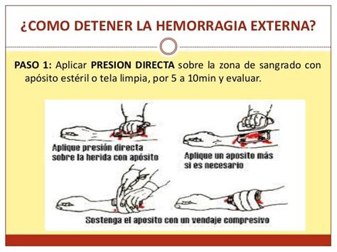 1 1 Concepto De Primeros Auxilios Doctor ¿qué Puedo Hacer