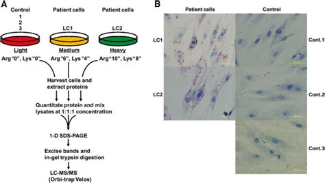 Silac Based Quantitative Proteomics A Flowchart Of Triple Silac