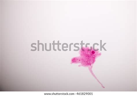 Amoeba Proteus Under Microscope Stock Photo 461829001 | Shutterstock