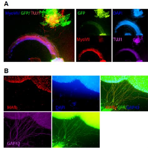 A B Tlx Expressing Esc Derived Neurons Are Attracted To Both